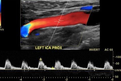 Curso completo de Doppler ($ARS)